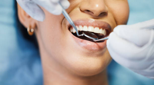 Best Urgent Care for Lost Fillings or Crowns in Indian Mountain Lake, PA